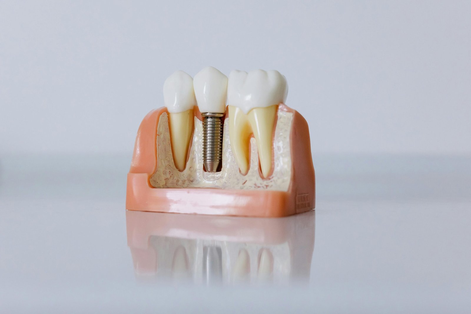 Oral Surgery